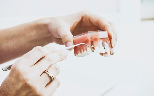 Informace pro občany - zhotovení zubních protéz